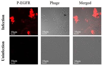 Activation of a Neospora caninum EGFR-Like Kinase Facilitates Intracellular Parasite Proliferation